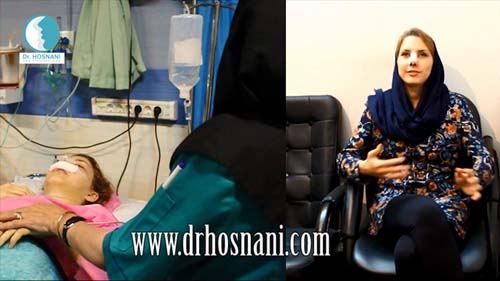 هزینه عمل بینی دکتر حسنانی
