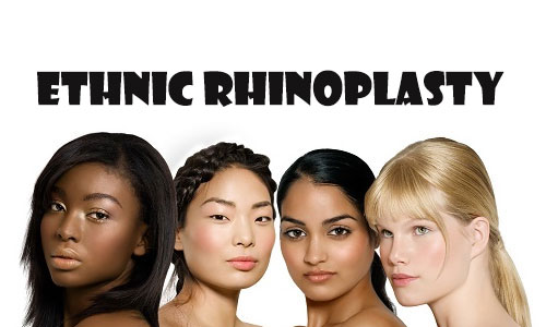 Ethnic rhinoplasty