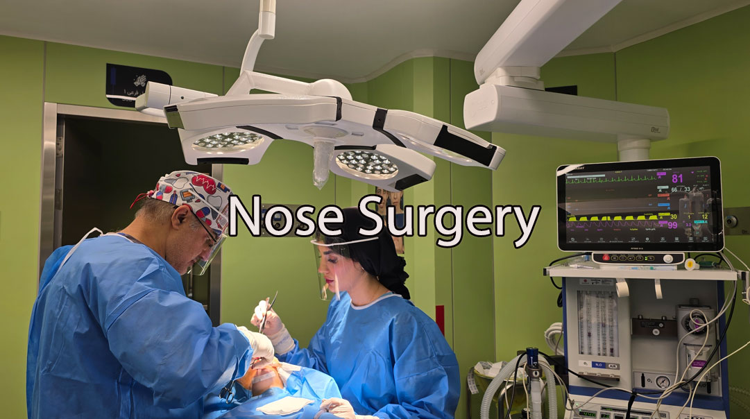 Rhinoplasty by Dr. Hosnani