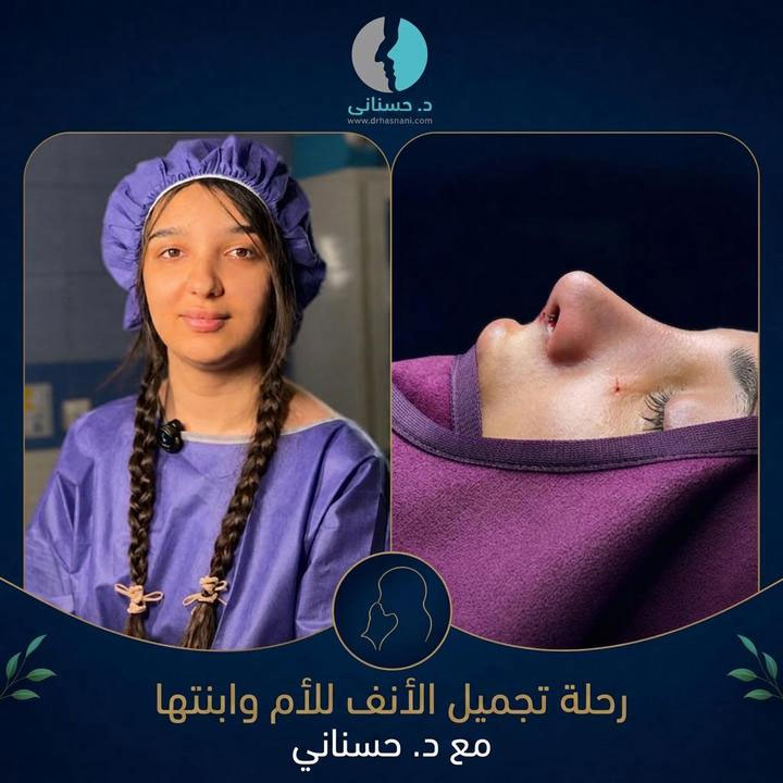 رحلة عملية تجميل الأنف بين أم وابنتها مع الدكتور حسناني