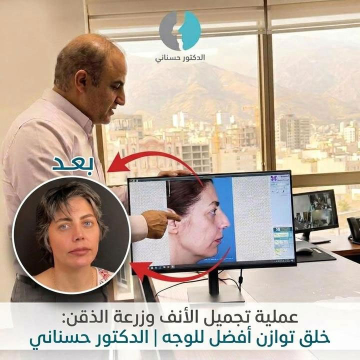 عملية تجميل الأنف وزرعة الذقن: خلق توازن أفضل للوجه | الدكتور حسناني