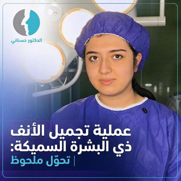 عملية تجميل الأنف ذي البشرة السميكة: تحوّل ملحوظ | الدكتور حسناني