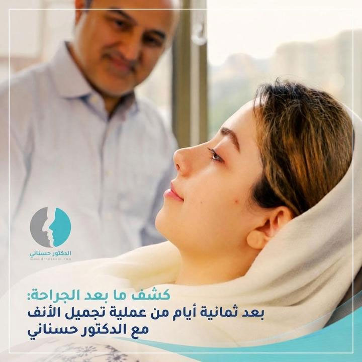 كشف ما بعد الجراحة: بعد ثمانية أيام من عملية تجميل الأنف مع الدكتور حسناني