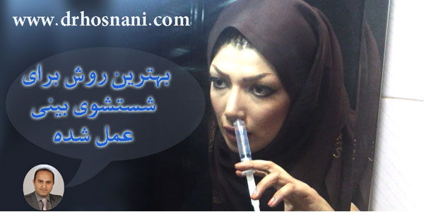 nasal irrigation