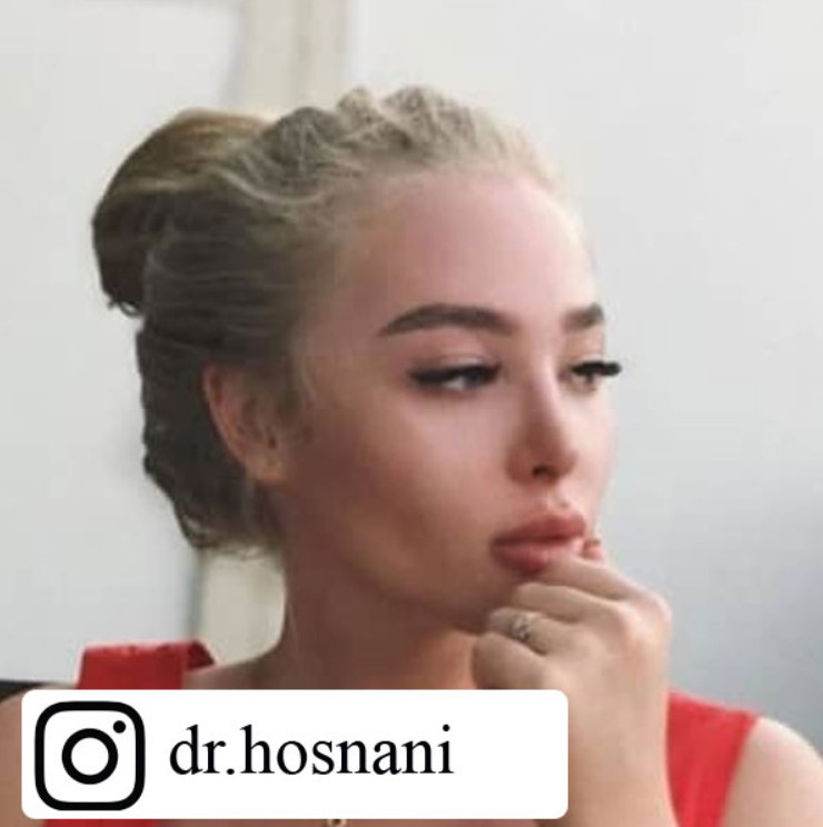 nose beauty