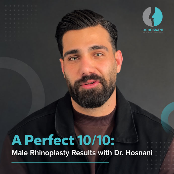 A Perfect 10/10: Male Rhinoplasty Results with Dr. Hosnani
