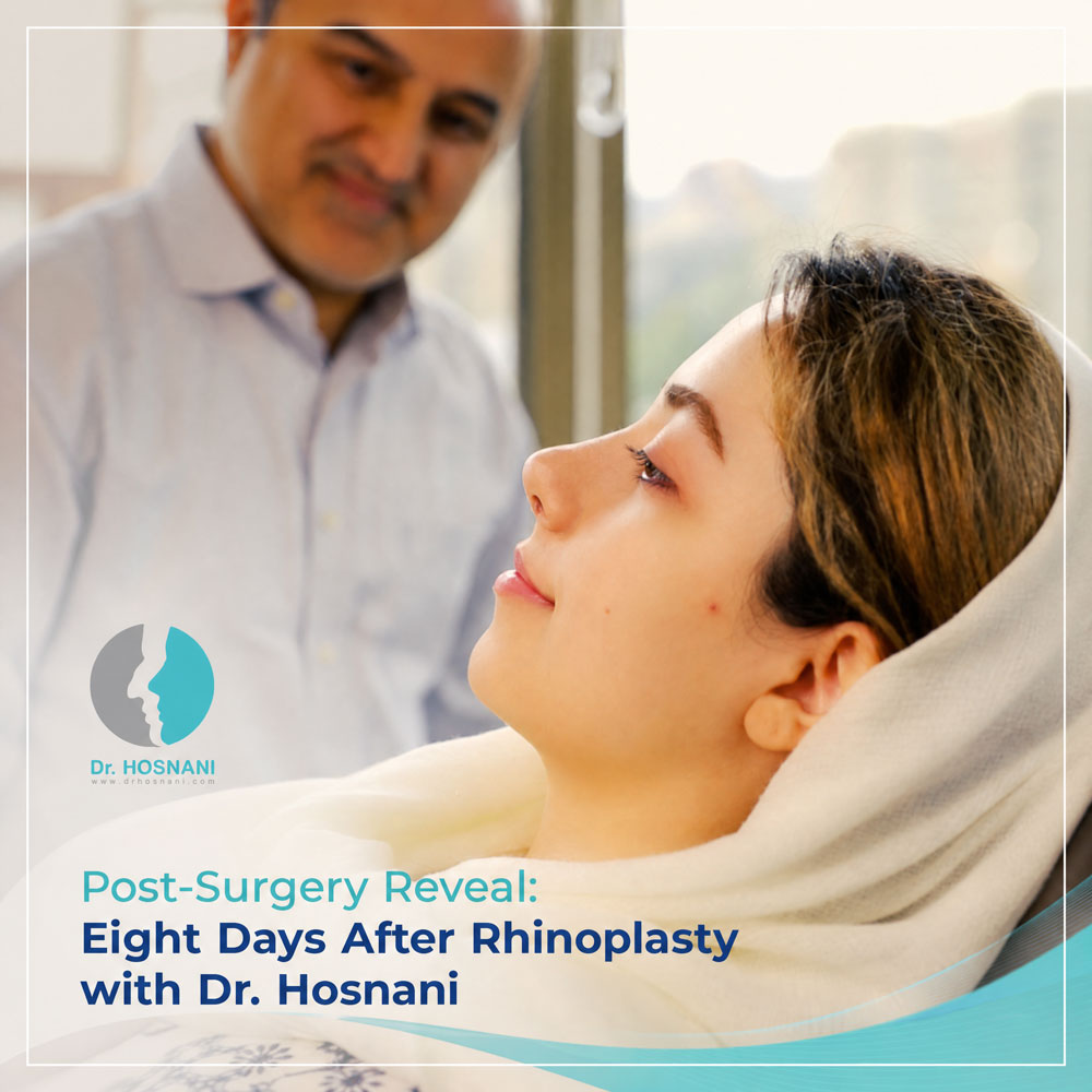 Post-Surgery Reveal: Eight Days After Rhinoplasty with Dr. Hosnani