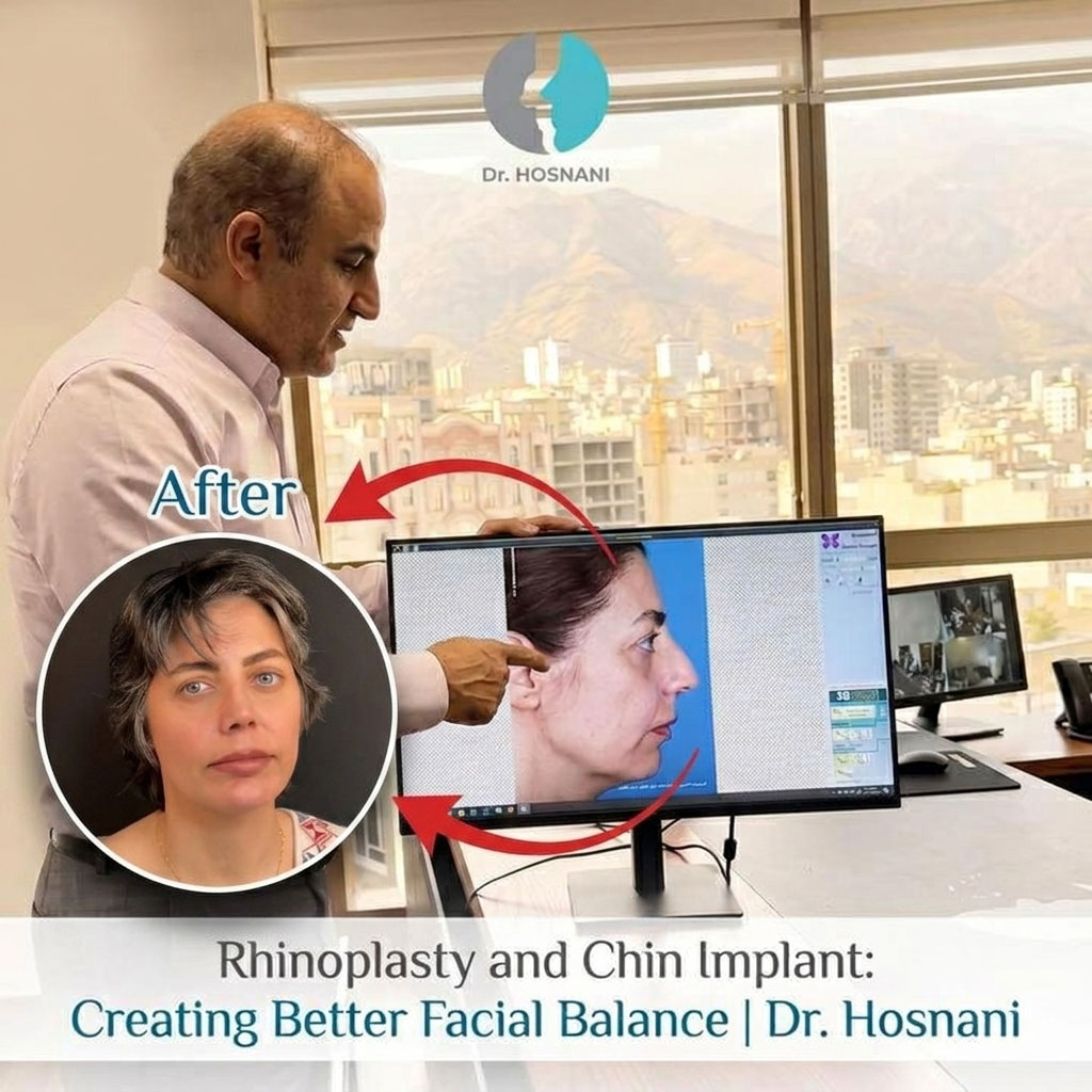Rhinoplasty and Chin Implant: Creating Better Facial Balance | Dr. Hosnani