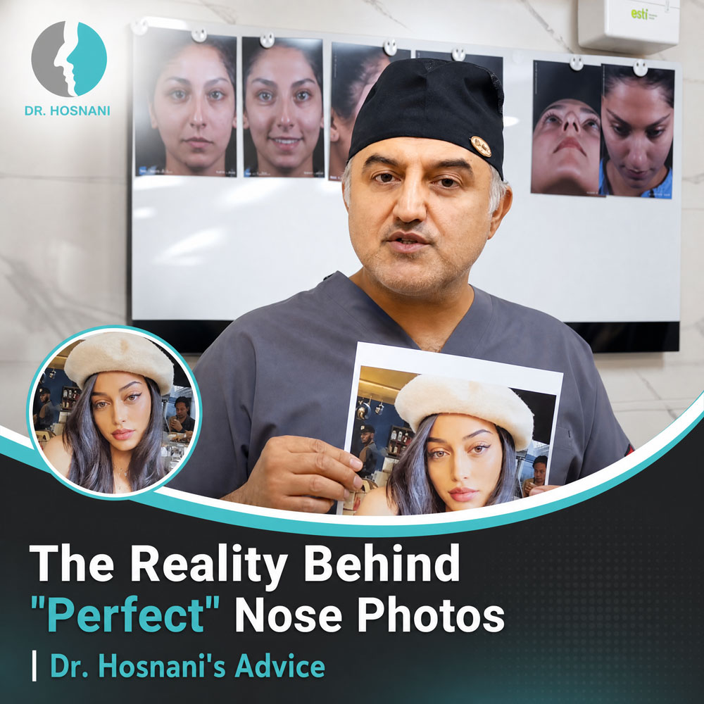 The Reality Behind "Perfect" Nose Photos | Dr. Hosnani's Advice