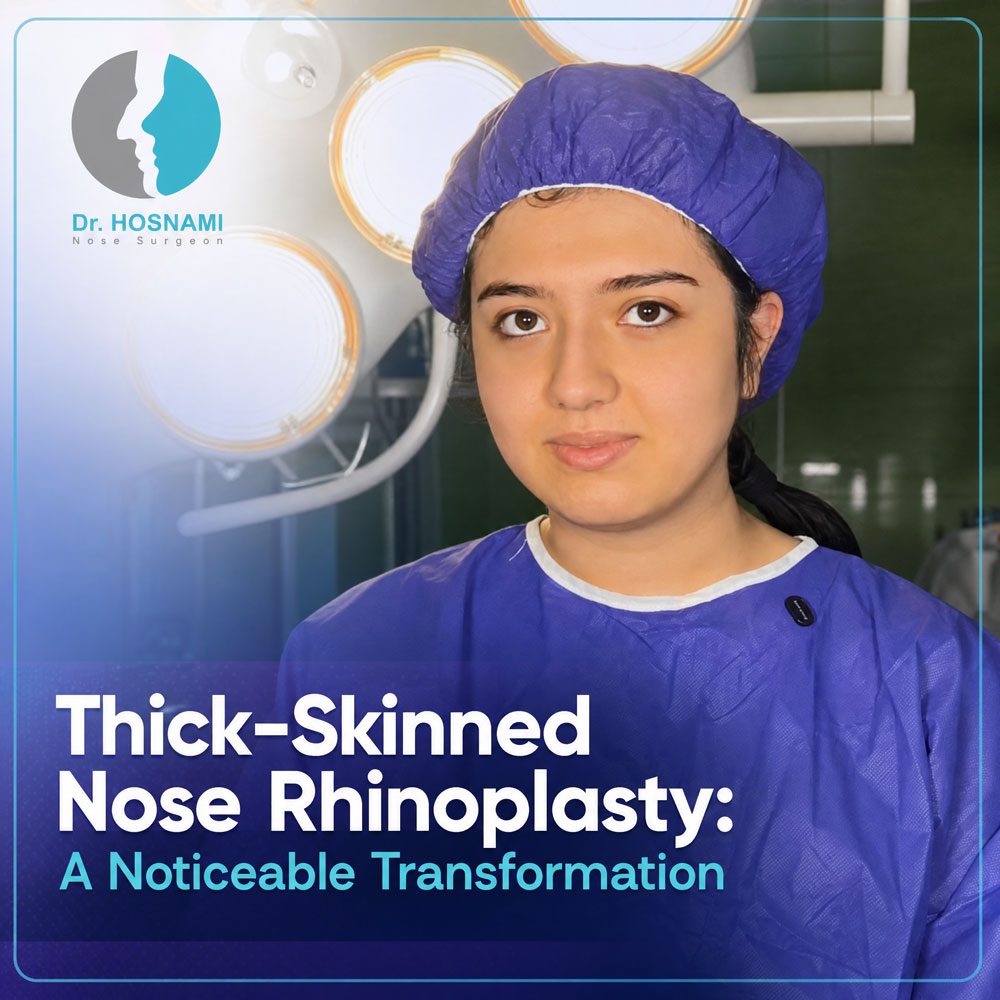 Thick-Skinned Nose Rhinoplasty: A Noticeable Transformation | Dr. Hosnani