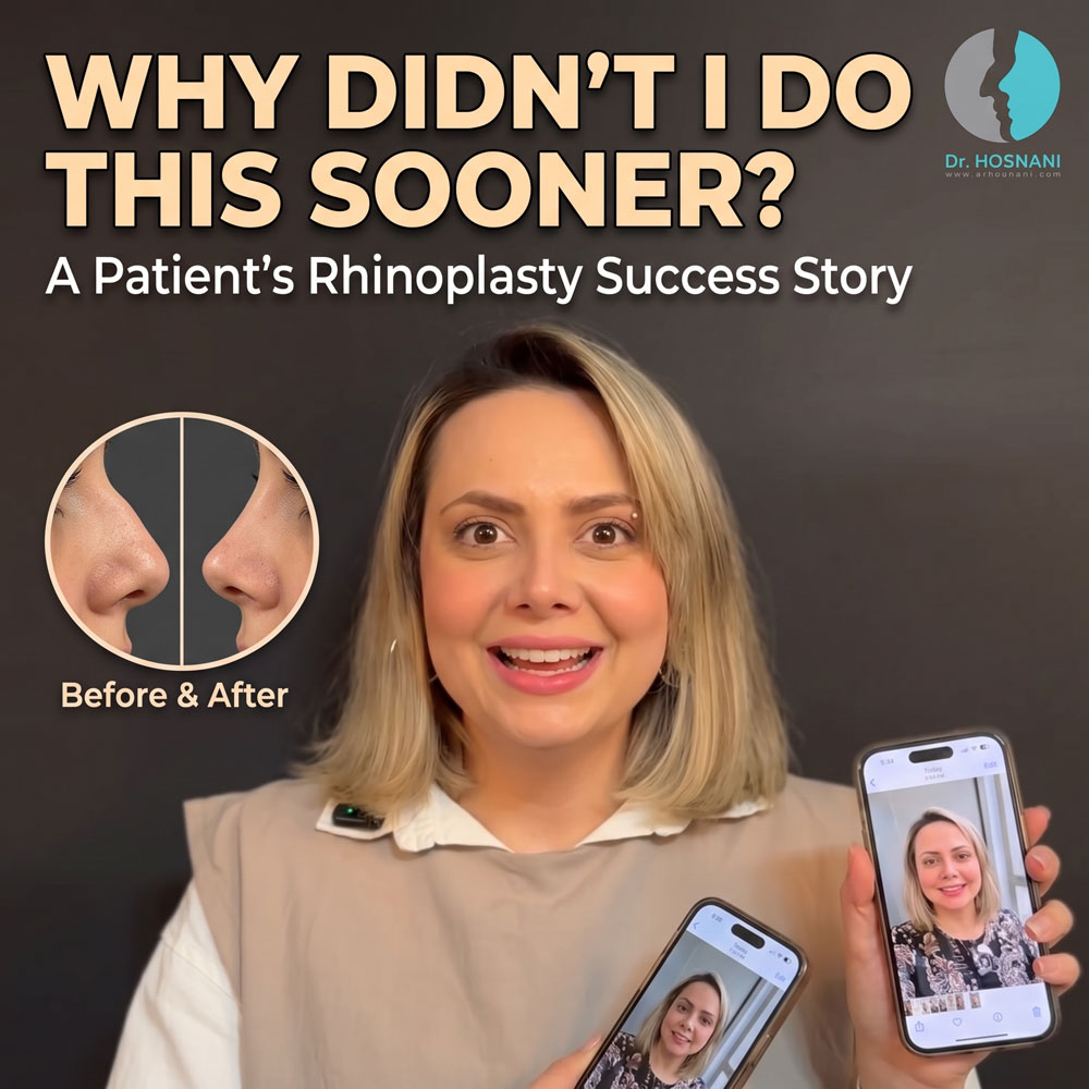 "Why Didn't I Do This Sooner?" A Patient's Rhinoplasty Success Story with Dr. Hosnani