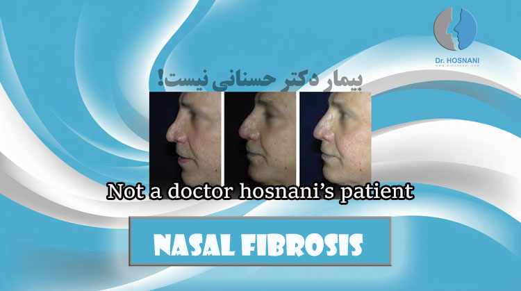 fibrosis