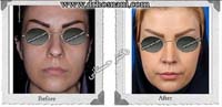 عمل بینی شماره 1005