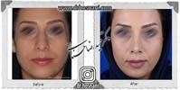 عمل بینی شماره 1007