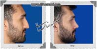 عمل بینی شماره 1012