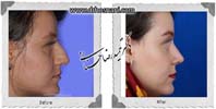 عمل بینی شماره 1014