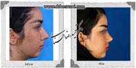 عمل بینی شماره 1034