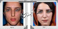 عمل بینی شماره 1051
