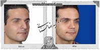 عمل بینی شماره 1073