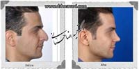 عمل بینی شماره 1074