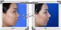عمل بینی شماره 1078