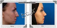 عمل بینی شماره 1086