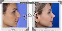 عمل بینی شماره 1092