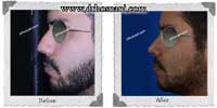 عمل بینی شماره 201