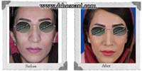 عمل بینی شماره 210