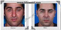 عمل بینی شماره 263