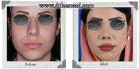 عمل بینی شماره 297