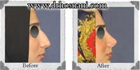 عمل بینی شماره 3