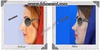 عمل بینی شماره 347