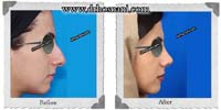 عمل بینی شماره 381