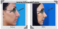 جراحی بینی -389