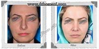 عمل بینی شماره 420