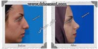عمل بینی شماره 431