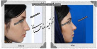 عمل بینی شماره 456