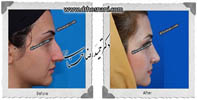 عمل بینی شماره 458