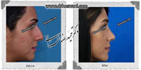  جراحی بینی -470