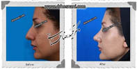 عمل بینی شماره 474