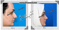 عمل بینی شماره 478