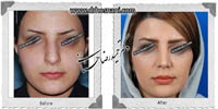 عمل بینی شماره 479