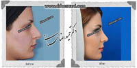 عمل بینی شماره 480