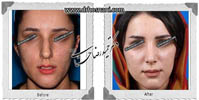 عمل بینی شماره 485