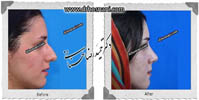 عمل بینی شماره 486