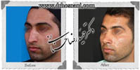 عمل بینی شماره 487