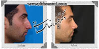 عمل بینی شماره 488