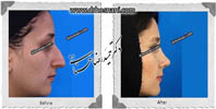 عمل بینی شماره 498