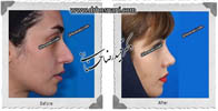 عمل بینی شماره 500